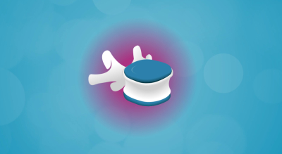 Abordaje integral del dolor lumbar: causas, ejercicios y tratamientos